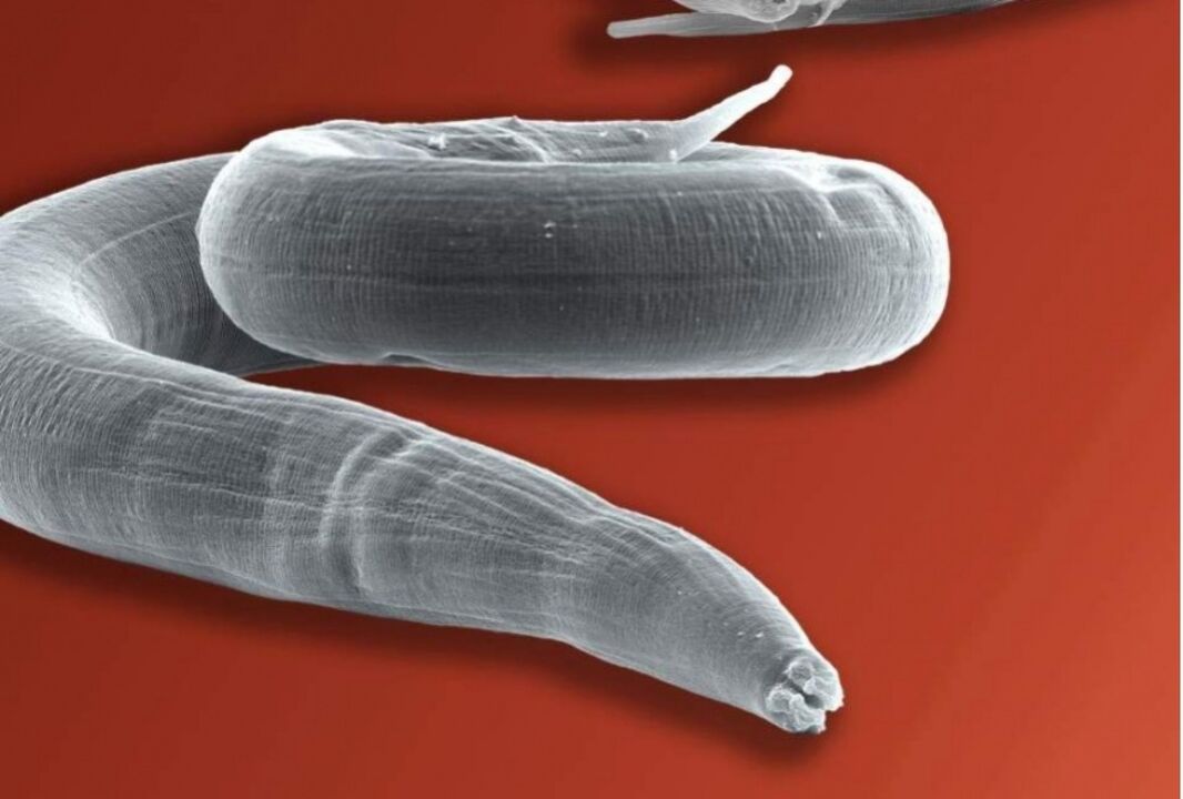 pinworm iš žmogaus kūno